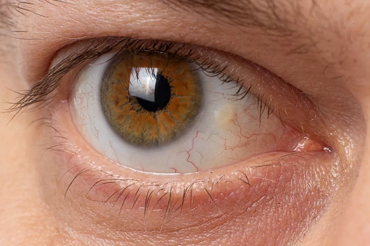 Черные точки в глазах - причины и лечение